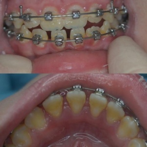 Фото от владельца Таландент, ООО, стоматологическая клиника