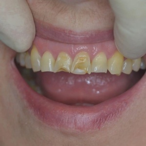 Фото от владельца Таландент, ООО, стоматологическая клиника