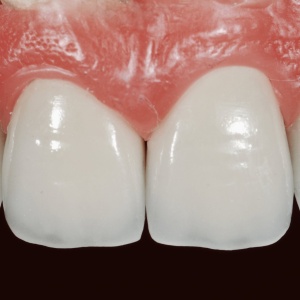 Фото от владельца Омнес, ООО, зуботехническая лаборатория