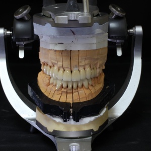 Фото от владельца Dental Partner, зуботехническая лаборатория