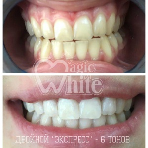 Фото от владельца Magic White, студия косметического отбеливания зубов